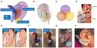 Auricular Vagus Neuromodulation—A Systematic Review on Quality of Evidence and Clinical Effects